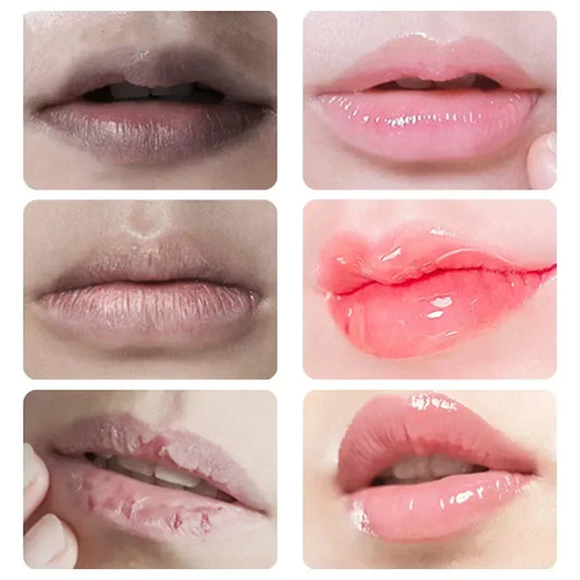 Remove Dark Lip Balm Lightening Melanin Mask Gloss Oil Exfoliating Clean Moisturizer Korean Care Products Beauty Health Makeup