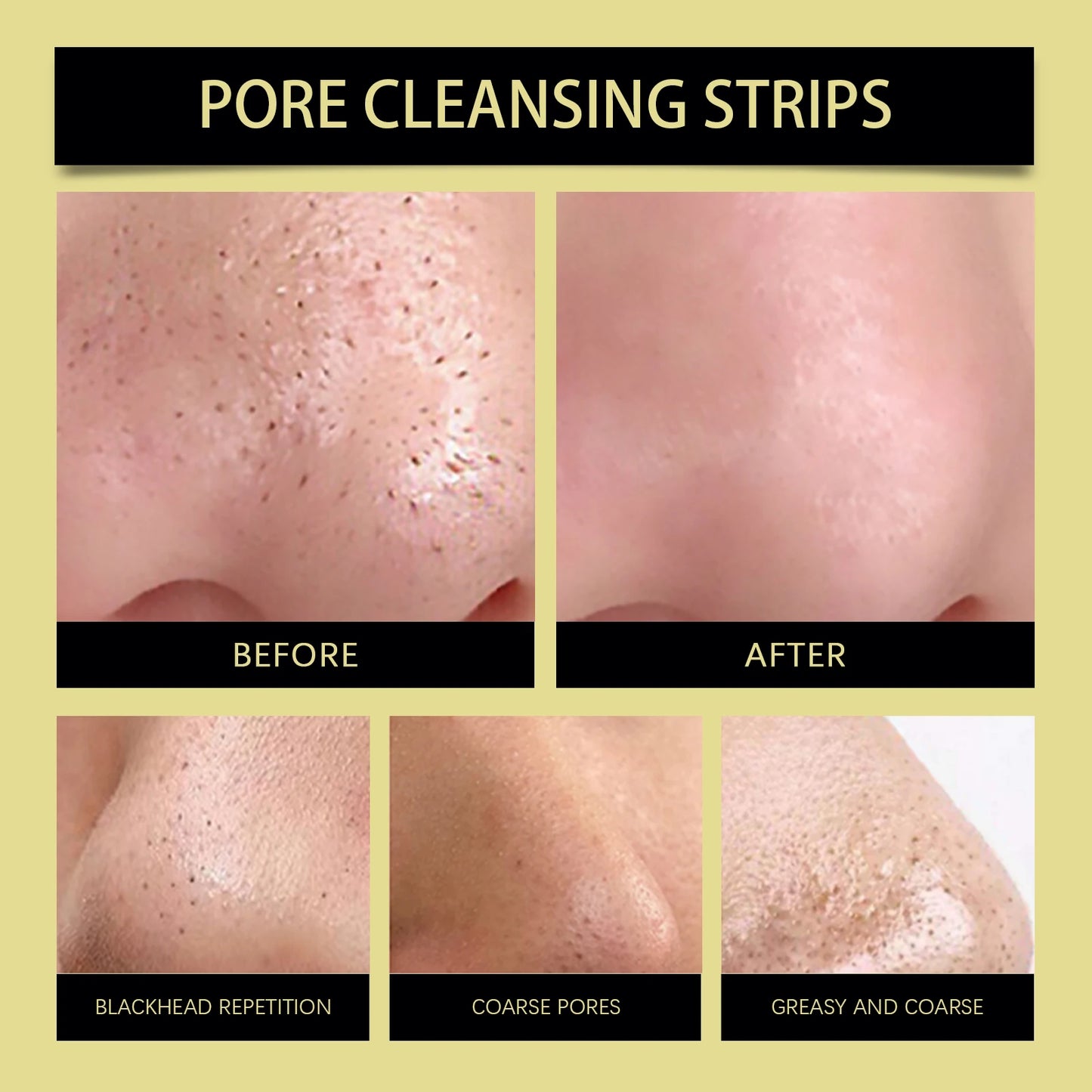 Cleansing Nose Patches, Gentle Cleansing of Pores, Acne, And Non Tight Nose Care Patches, Suitable for All Skin Types