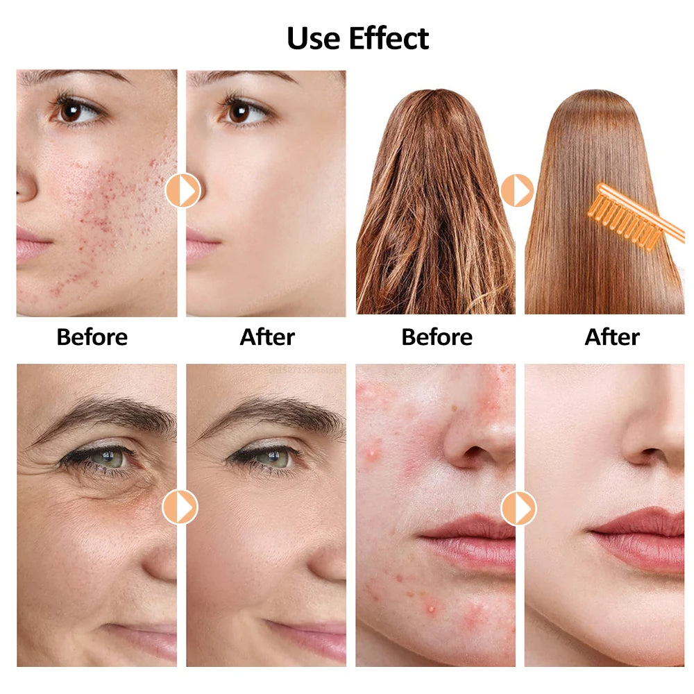 Portable High Frequency Facial Machine Skin Therapy for Face Acne Massage Skin Rejuvenation Tightening Wrinkle Reducing Tool