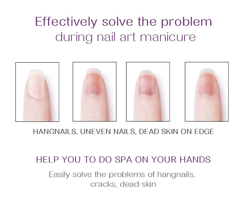 Nails Nutrition Oil & Cuticle Oil Nail Poilsh Care Fruit Flavor Cuticle Manicure Protection Nail Supplies