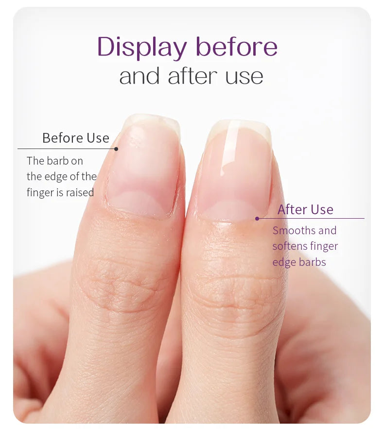 Nails Nutrition Oil & Cuticle Oil Nail Poilsh Care Fruit Flavor Cuticle Manicure Protection Nail Supplies