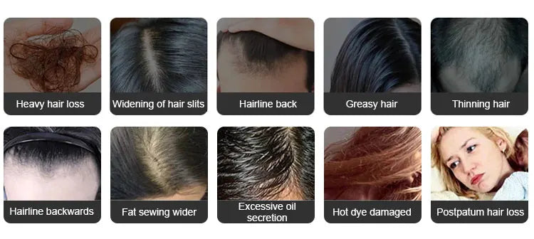 Electric Laser Hair Growth Comb Anti Hair Loss Massage Therapy Infrared RF Red Light EMS Vibration Massager Hair Brush Hair Care