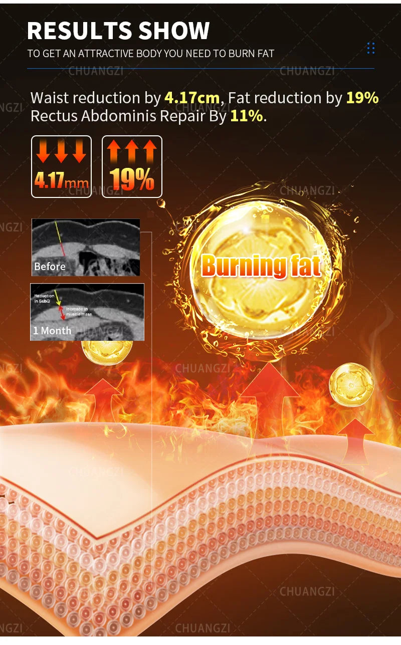 EMS Weight Loss Stimulating Muscle Slimming Fat Removal Muscle Fitness Sculpting MYOslim Machine 4 Handles Beauty Salon