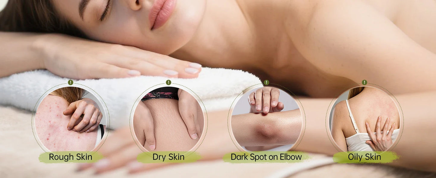 VETES Remove Dead Skin Body Scrub 250g Exfoliant Gentle No Irritation Scrub Cream Moisturizing Hydrating Deep Cleans Body Care