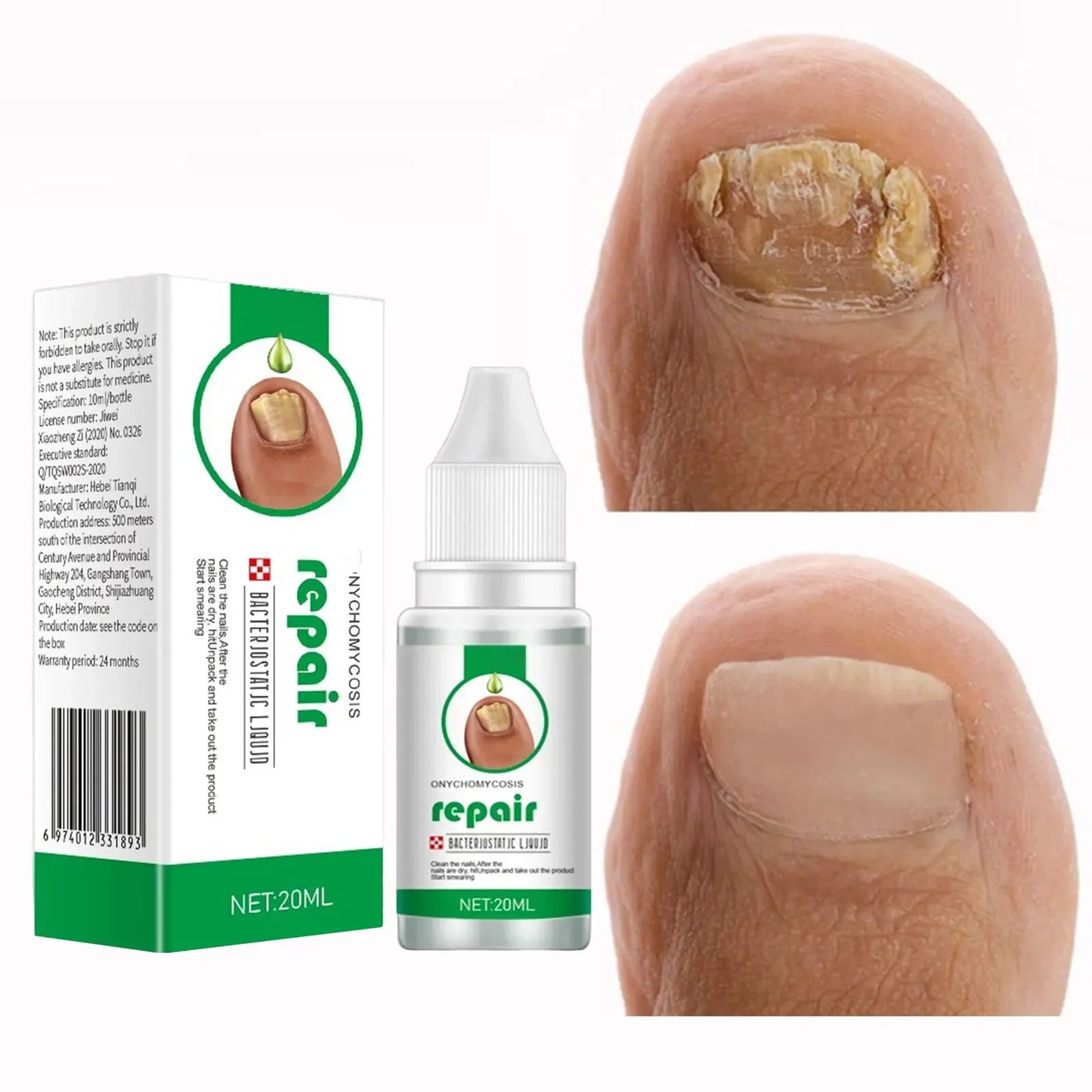 Nail Fungus Treatment 20ml Nails Repair Essence Liquid Renew Damaged Broken Cracked & Discolored Nails for Damaged Nail Uñas