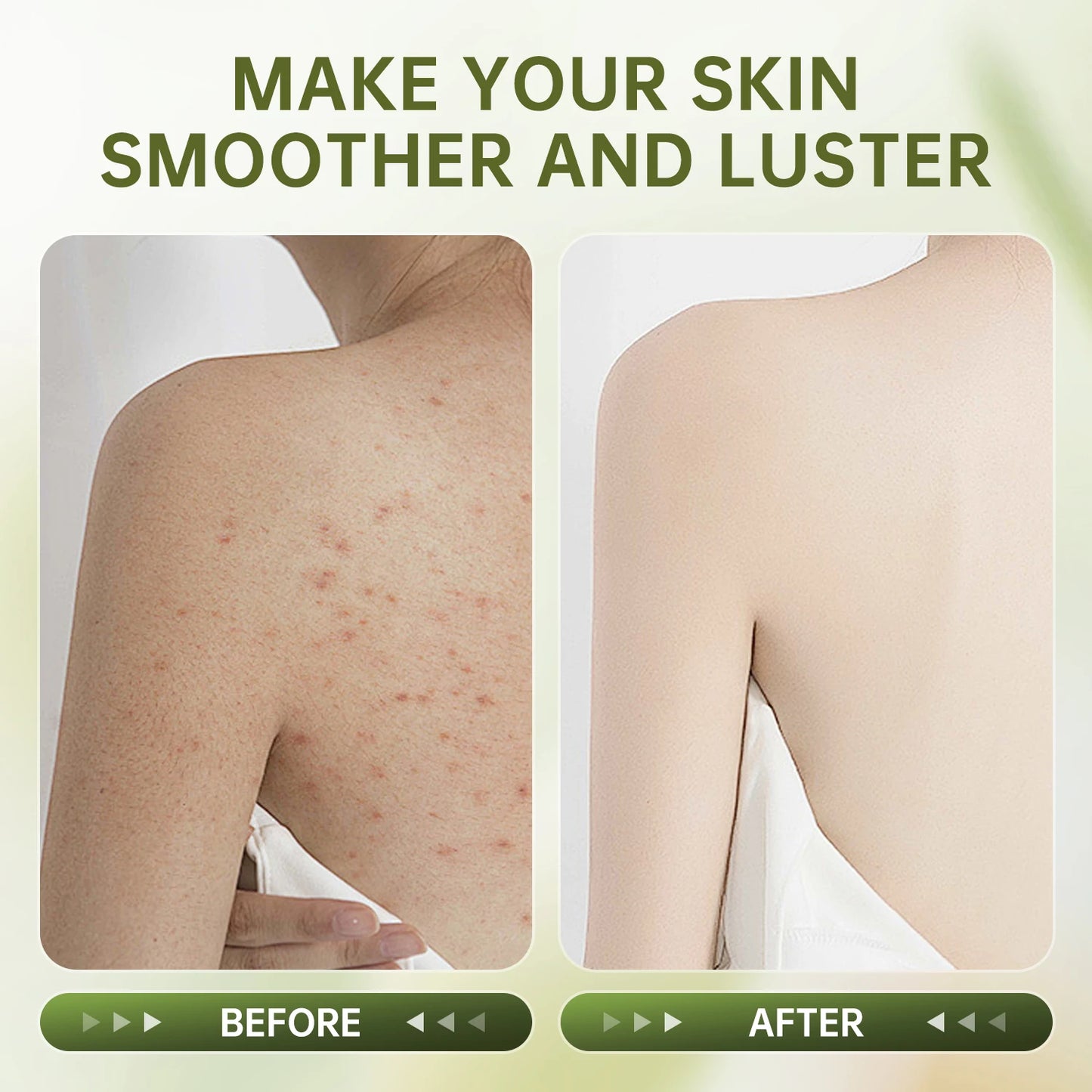 VETES Remove Dead Skin Body Scrub 250g Exfoliant Gentle No Irritation Scrub Cream Moisturizing Hydrating Deep Cleans Body Care