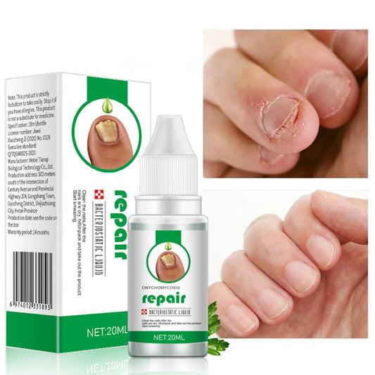 Nail Fungus Treatment 20ml Nails Repair Essence Liquid Renew Damaged Broken Cracked & Discolored Nails for Damaged Nail Uñas